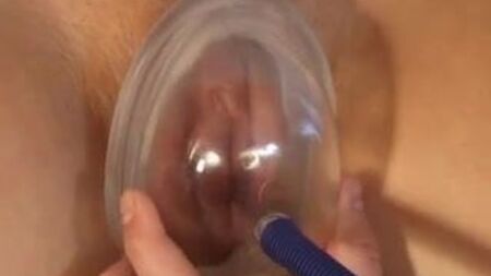 Vaginalpumpe