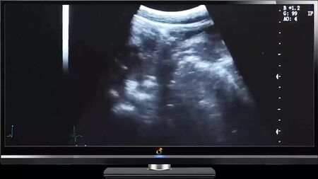 Papa – Ultraschall – Tiefes Ficken