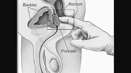 So melkst du deine Prostata selbst